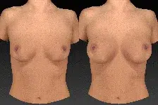 Breast-Aug-Nude-Animation-web