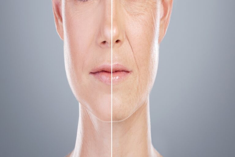 Collage showing before and after images of a woman’s face highlighting skincare, anti-aging, and beauty transformation with cosmetic treatment against a gray studio background
